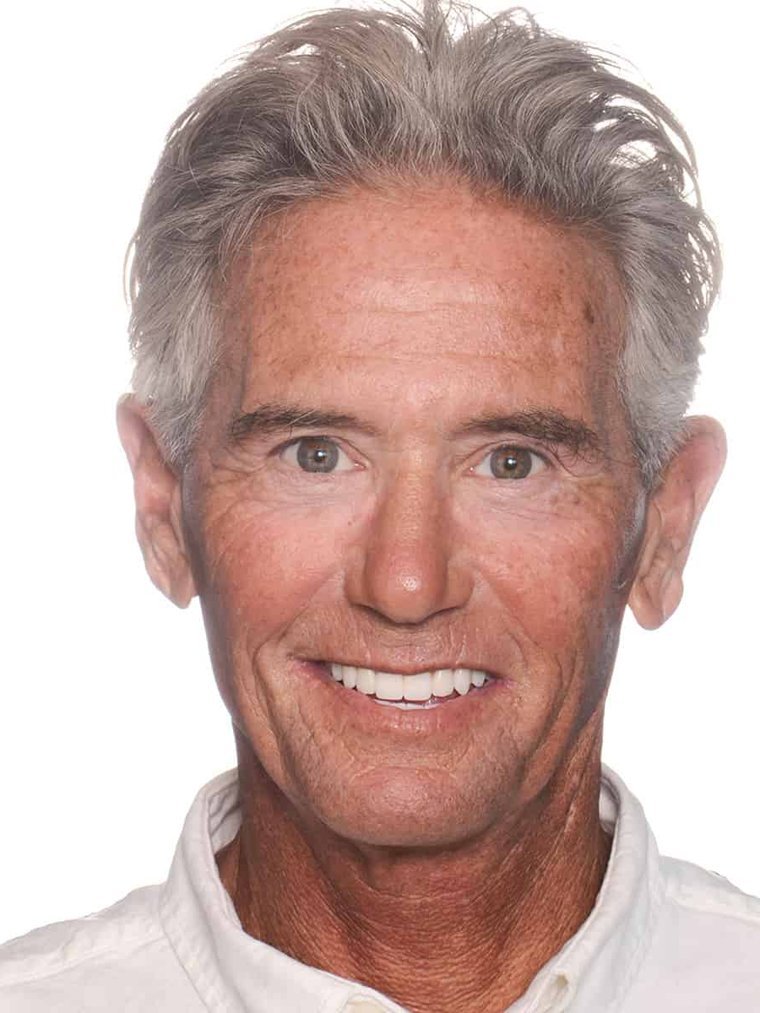 After dental implant restoration